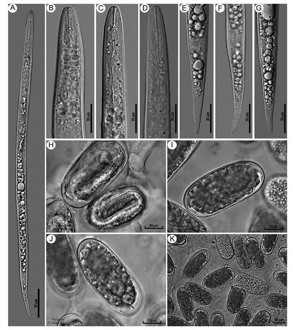 Microscopía de huevos de nematodo mostrando la capa quitinosa