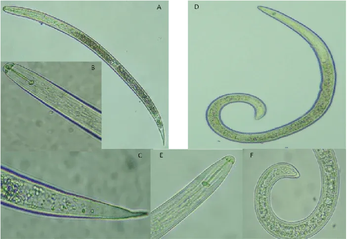 Microscopía de juveniles J2 de Meloidogyne